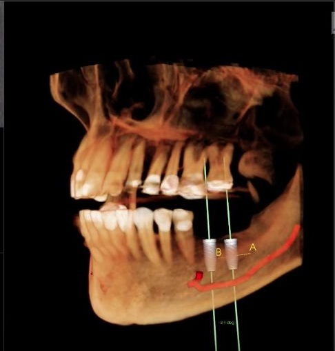 Small Image